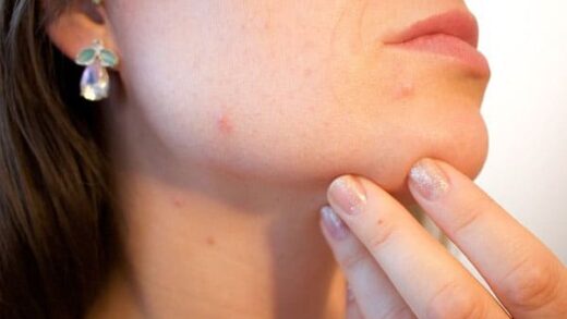 10 сигналов кожи лица о неполадках в организме