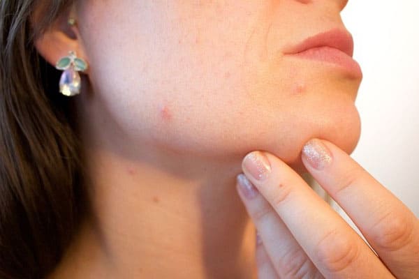 10 сигналов кожи лица о  неполадках в организме